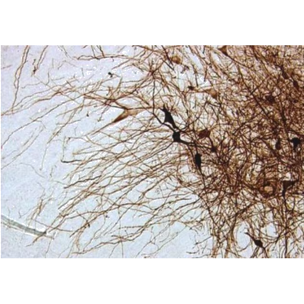 ANTICUERPO TYROXINE HYDROXYLASE MSX-40G