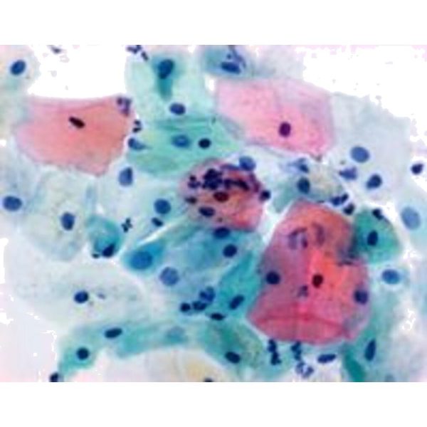 SOL. PAPANICOLAU HEMATOXILINA HARRIS 2.5 LTS